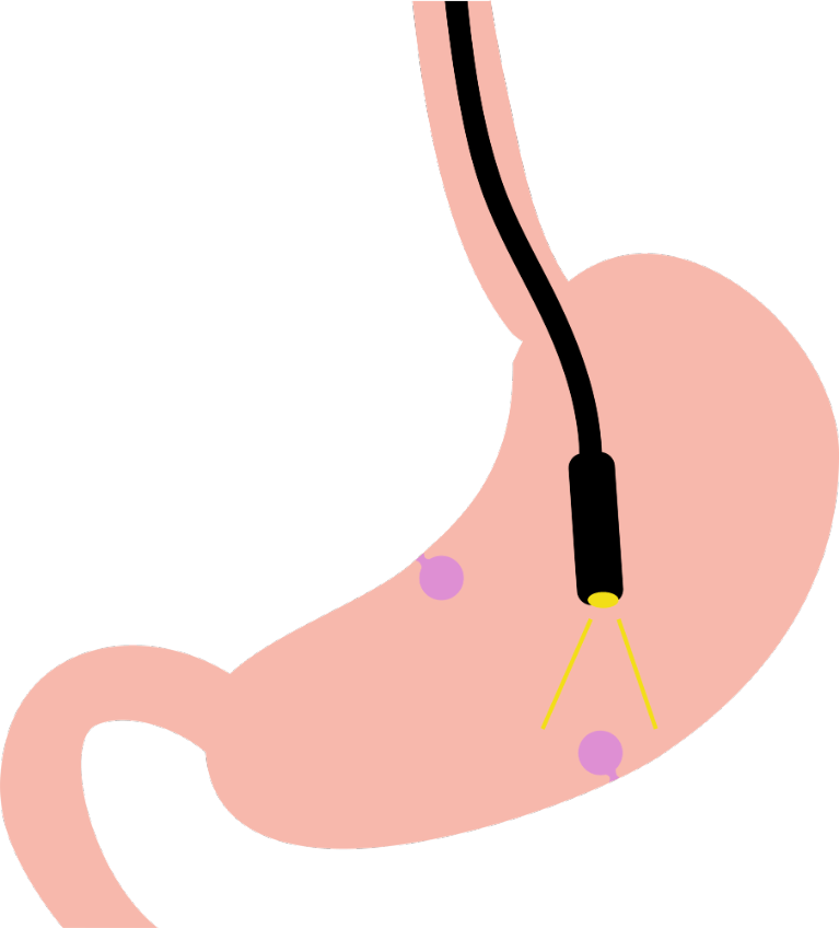 胃と大腸の同日検査が可能
